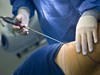 Liposuction Surgery Weight Loss